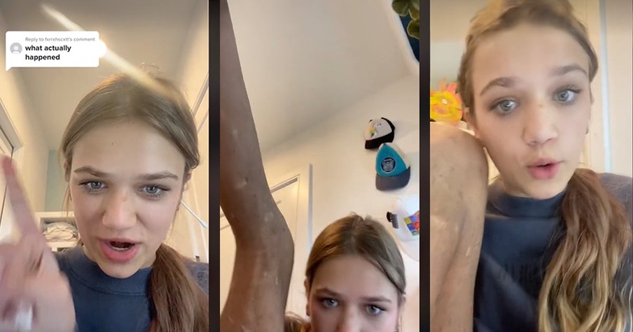 Teen Gets Candid About Her Rare Disorder And Unexpectedly Goes Viral