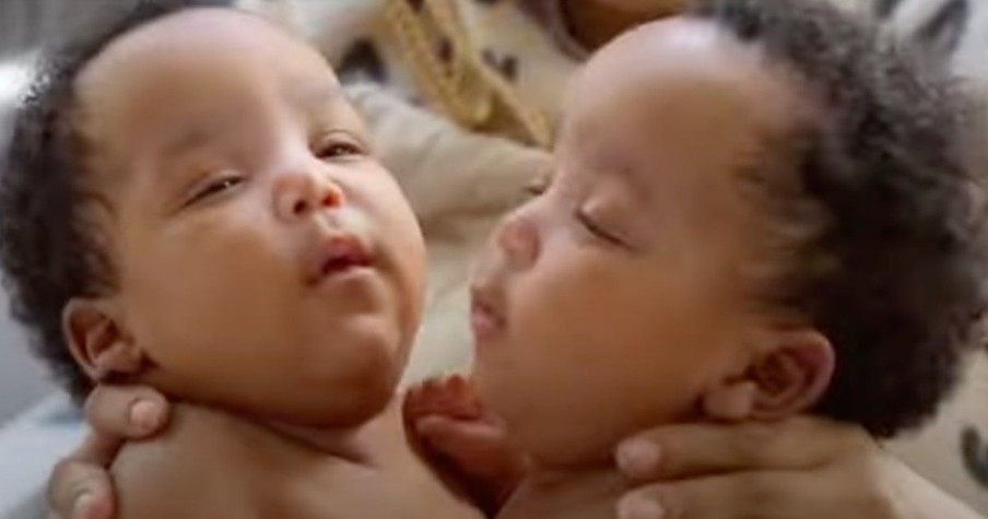 These Former Conjoined Twins Finally Go Home After Their First Birthday