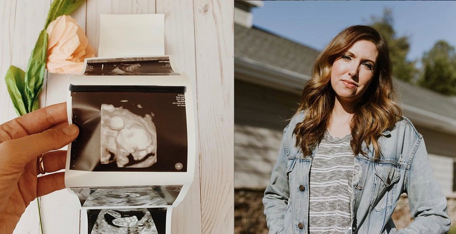 Francesca Battistelli & Husband Say Urgent Prayer As Grapefruit-Sized Cyst Threatens Pregnancy