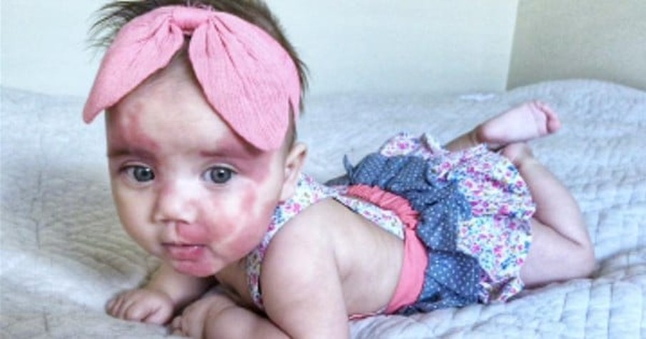 Some Had The Nerve To Call This Baby Girl 'Hideous' But She's Not Letting It Hold Her Back