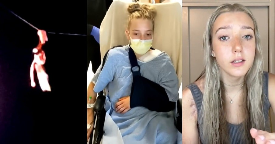 Teen Hanging from a Power Line Fears She's 'Done,' but Here's the Story of How She Survived