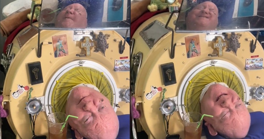 Man Who Lived in an Iron Lung for 70 Years Has Died but Left Behind a Legacy of Inspiration