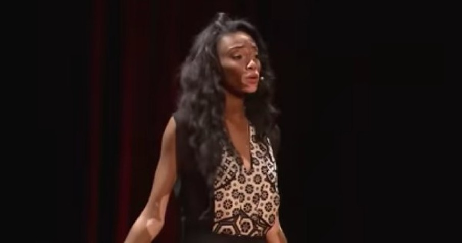 Many People Struggle To Cover Up Their 'Flaws' But Not THIS Woman. Hear Why She Refuses To HIDE!