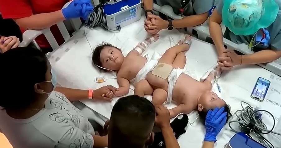 Parents Pray Over Conjoined Twins Separated In Texas And Praise God As The Boys Head Home