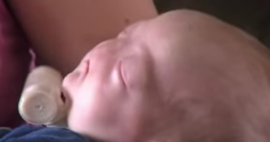 This Mom Tells Doctors Her Baby Is Perfect Just The Way He Is