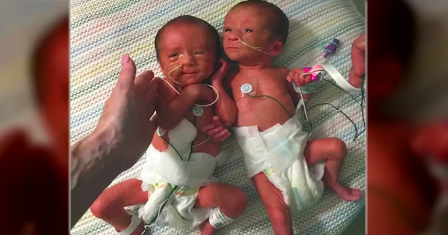 Premature Twin Girls Born No Bigger Than A Soda Bottle Are Out Of The ICU And Headed Home