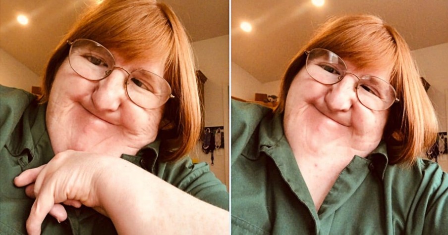 Told She's 'Too Ugly' to Post Selfies, Woman with Freeman-Sheldon Syndrome Has Best Response