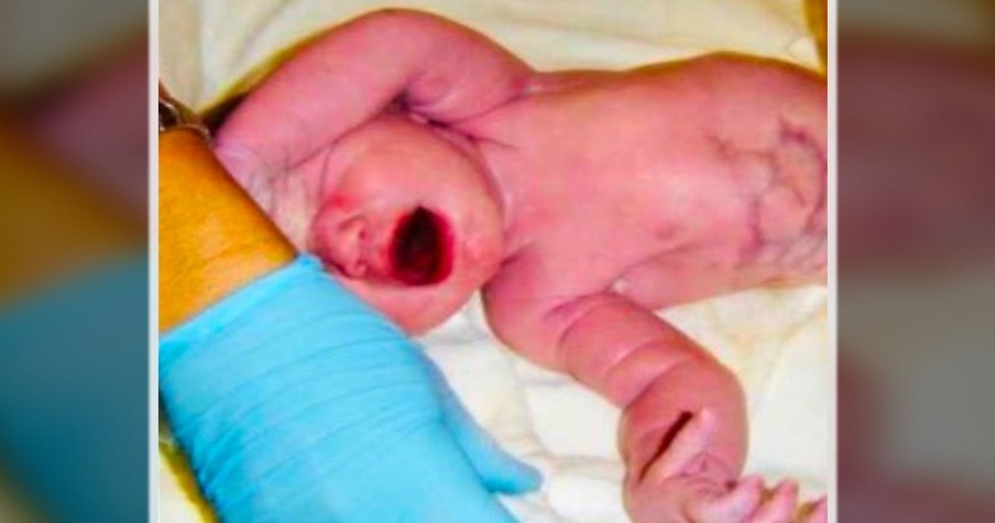 Mom Is Left Terrified As Doctors Take Off with Her Newborn Baby Before She Can Even Hold Him