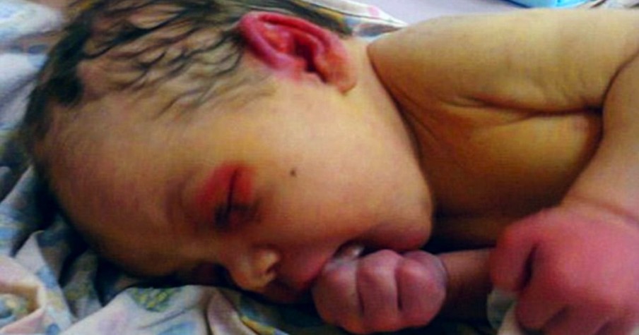 3-Day-Old Abandoned Baby Being 'Eaten Alive' By Ants Saved By Divine Intervention