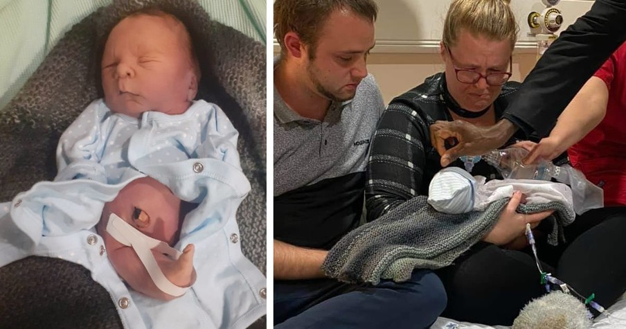 Baby Born With Mermaid Tail Lives Just Long Enough For Parents To Hold Him As He's Baptized