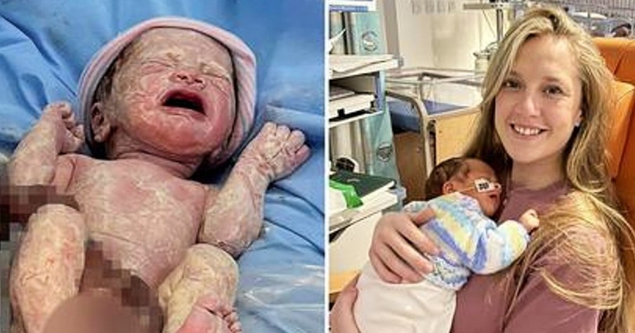 Mom Is In For Delivery Room Shock When Her Baby Is Born With Organs Outside Of Body