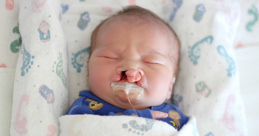 Parents Of Baby With Severe Cleft Palate Have Faith Restored By Kind Stranger