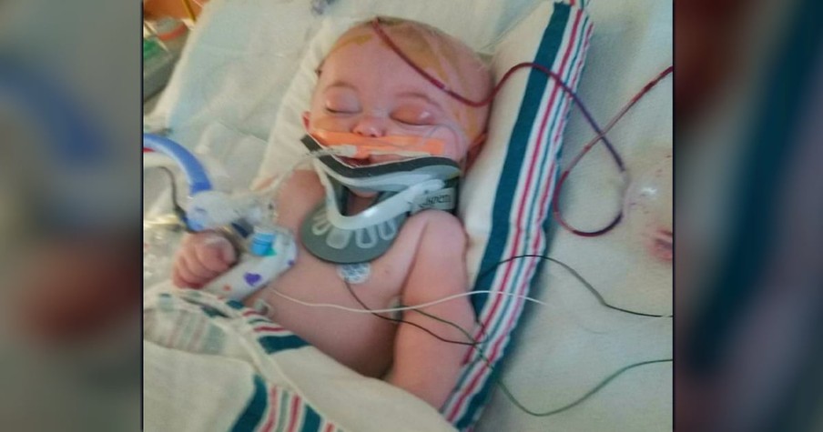 Mom Warns Others After A 2-Foot Fall Nearly Killed Her Precious Baby Boy