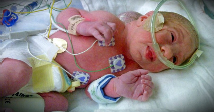 Baby Girl Born With Brain Growing Outside Of Skull Defies The Odds