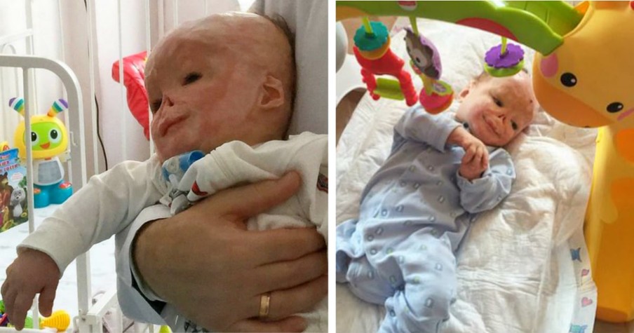 Baby In Russia Gets Abandoned By His Mother After He Suffers A Terrible Accident In The Hospital