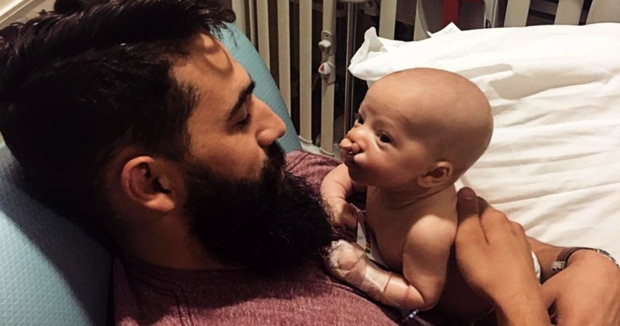 Dad Has Best Reply When Friend Says Parents Should End Pregnancy of Baby with Cleft Lip