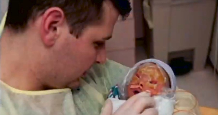 Parents Looked at Newborn’s Face And Feared Something Was Terribly Wrong