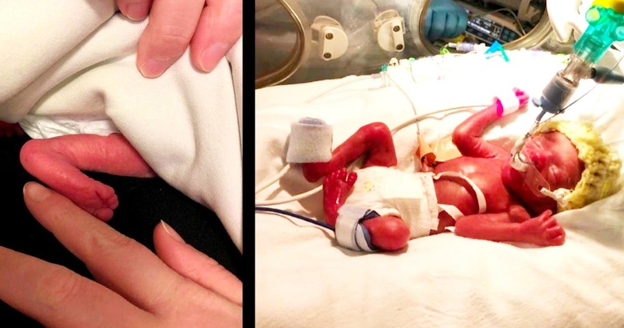 He Was Born So Tiny at 24 Weeks His Foot Was the Size of His Mom's Finger But Look at Him Now