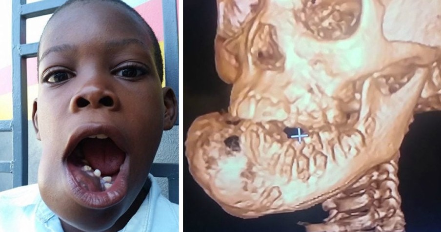 God Uses Christian, Muslim, & Jew to Save A Little Boy With Facial Tumor