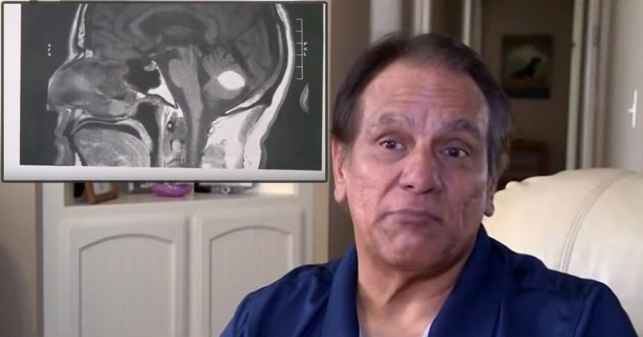 Doctors Left Baffled After Deadly Mass In Man's Brain Mysteriously Vanishes