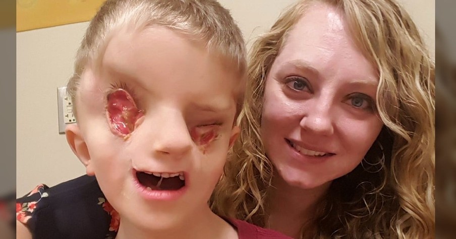 People Asked Mom Why She Kept Her Son And Her Reply Shows God Still Works Through Tragedy