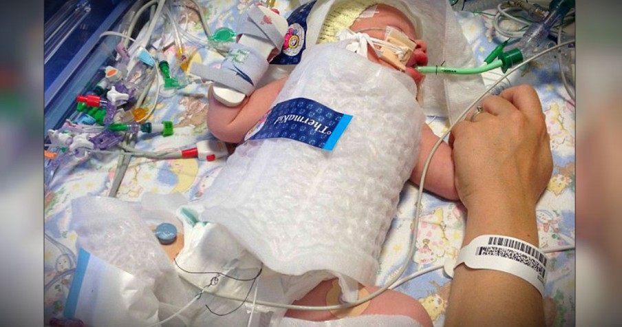 Doctors Put A Baby Boy Into A Freezer Bag To Save Him