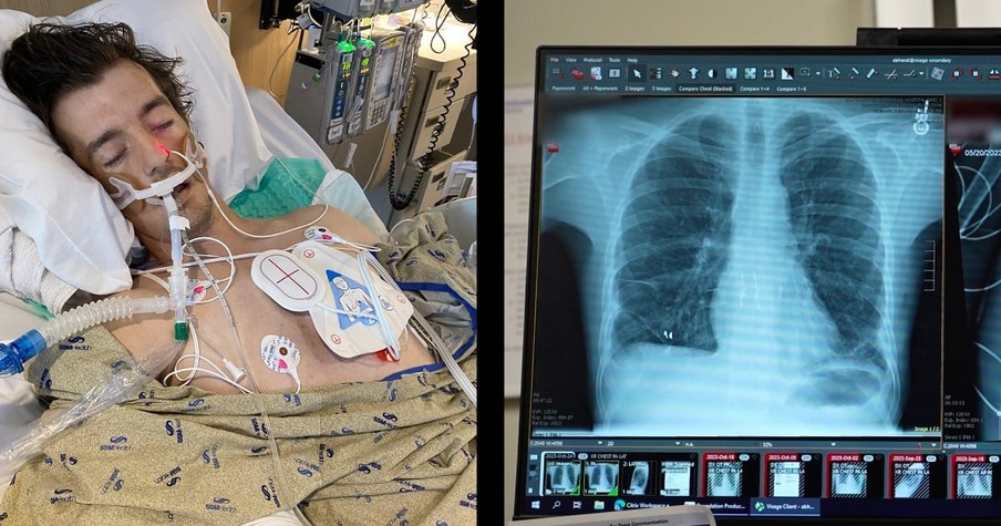 Doctors Get Creative to Give 'Fighting Chance' to Man with Flu Needing Double Lung Transplant