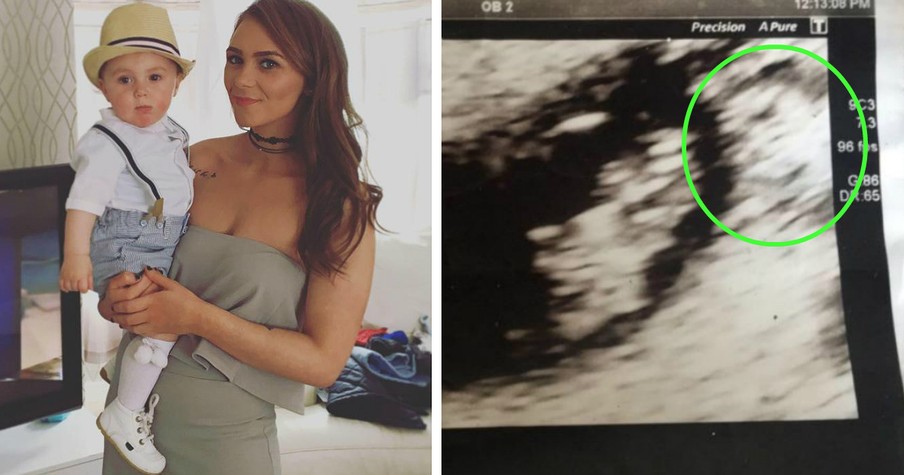 Mom Spots 'Guardian Angel Granddad' In Ultrasound During Miracle Pregnancy