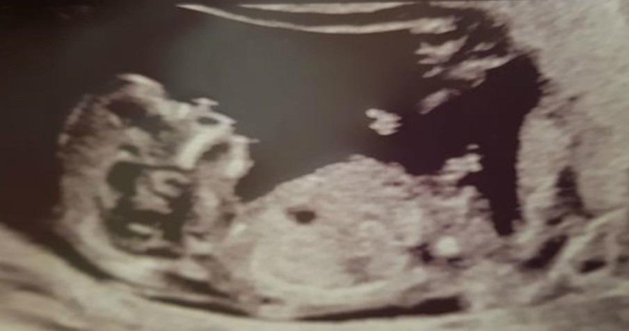 Guardian Angel Seen In Ultrasound With Miracle Baby After Doctors Said Couple Couldn't Have Kids