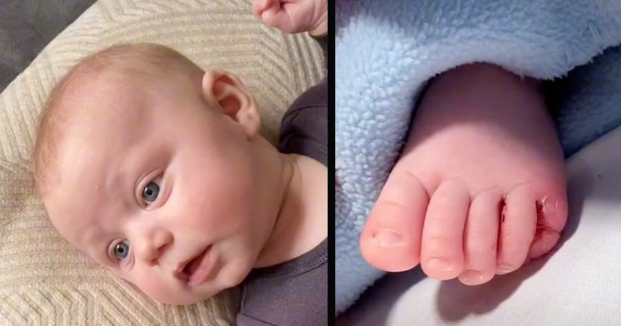 Mom Urges To Check Kid's Feet For Hair Around Toe After Her Baby's Terrifying Hospital Trip