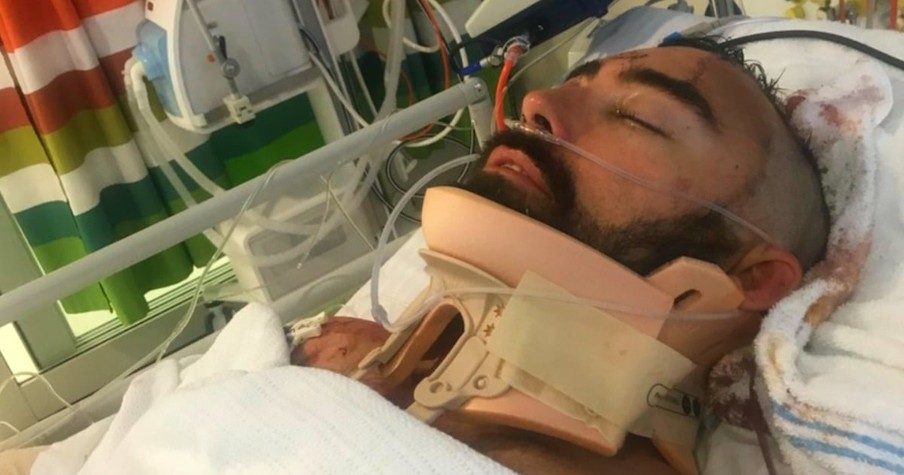 Heroic Dad Fights For Life After Diving Head First Off Balcony To Save His Son