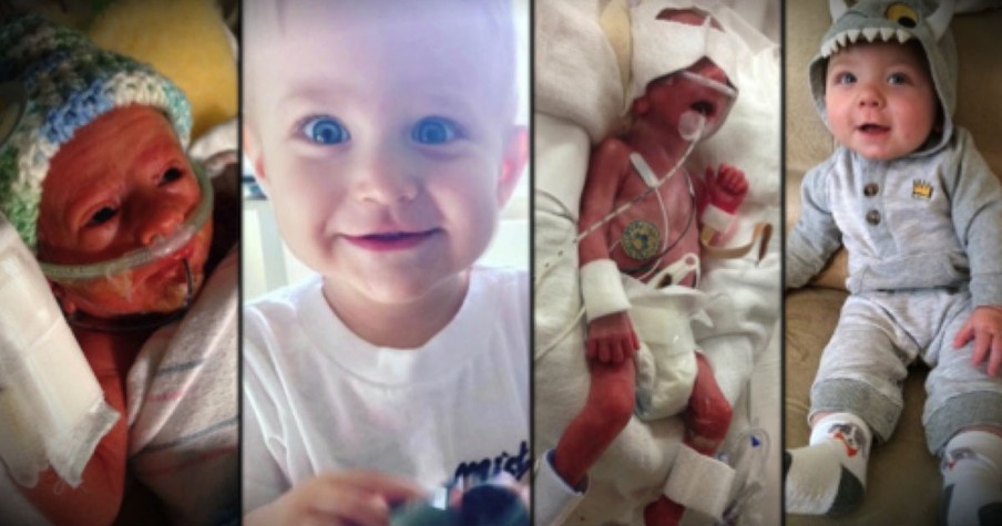 14 Photos Of Preemie Babies Who Defied The Odds