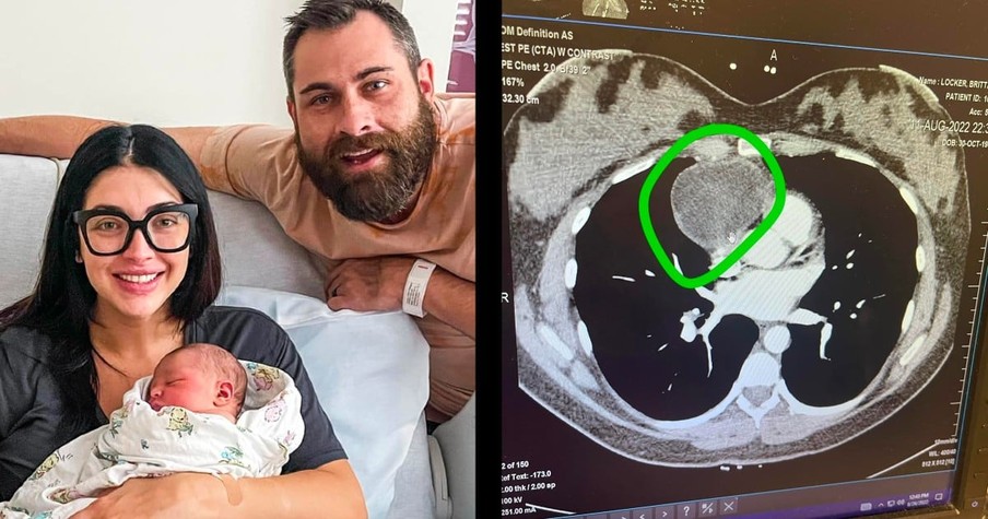 Mom Praises God After Pregnancy Reveals A Large Mass In Chest And Saves Her Life