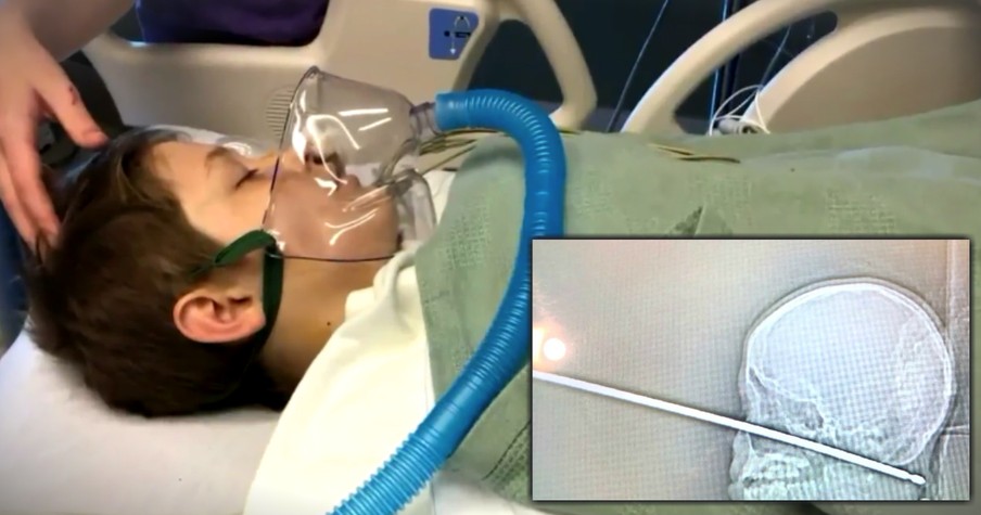 Family Credits God After Son Survives Horrific Face-First Fall Onto Meat Skewer