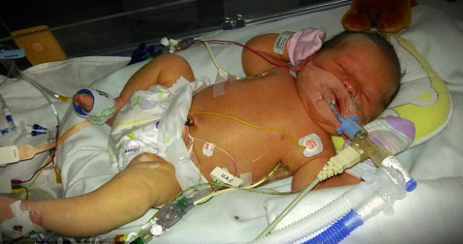 Miracle Baby Baffles Doctors When She Was Born With More Water In Her Body Than Blood