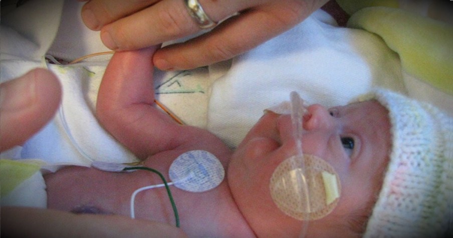 Born With No Kidneys, This Baby Is A True Miracle