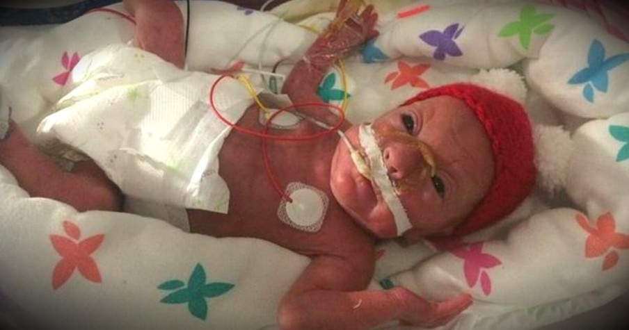 Baby Born Weighing Less Than A Bunch of Grapes Defies The Odds