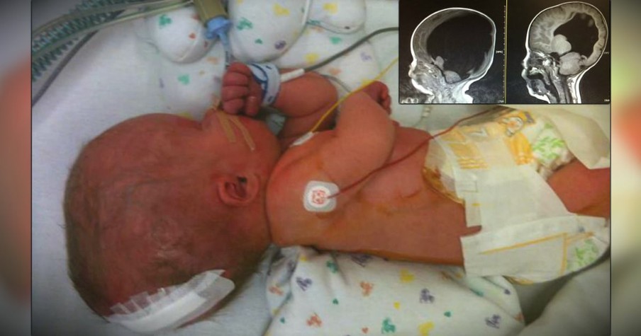 Mom Plans Funeral While Pregnant For Baby With Virtually No Brain Function & Then Gets A Miracle