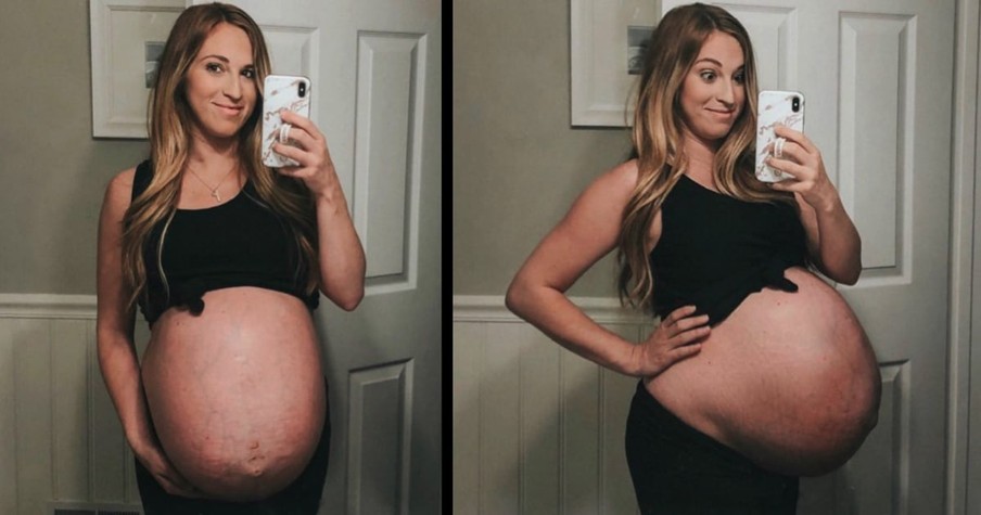 Mom Gives Birth To Quadruplets And Then Gets Brutally Honest With Before And After Photos