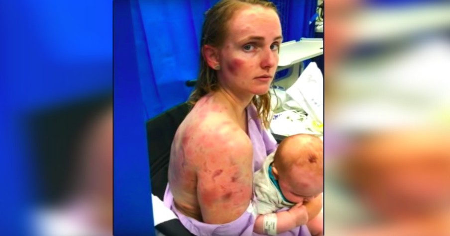 Brave Mom Shields Baby With Her Own Body From Intense Hail During Storm