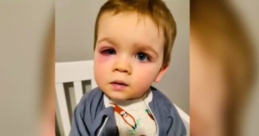 Mom Warns Others When Her Toddler Was Nearly Blinded from Popular Bath Toy