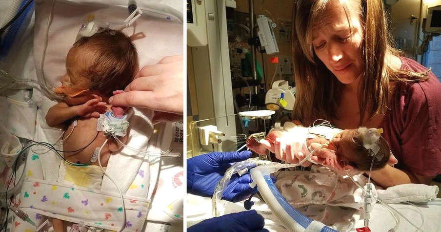 Cops Step In At NICU When Parents Of 'Mystery Baby' Must Return To Work