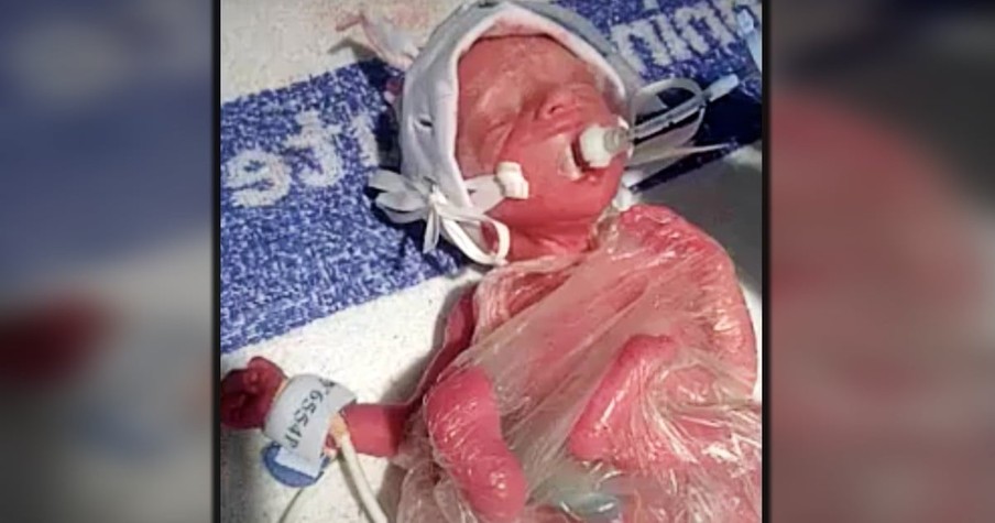 Baby Was So Tiny Doctors Used a Sandwich Bag to Save Her But Just Wait to See Her Now