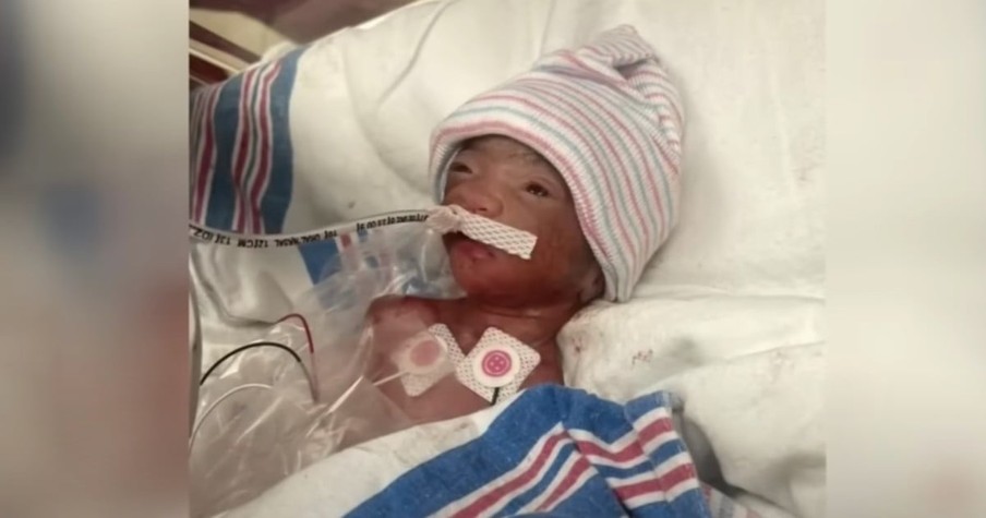 Following Lots of Tears and Prayers, Baby Born at 1lb Goes Home After Nearly 500 Days in Hospital