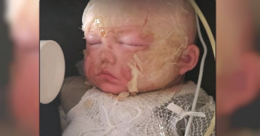 Two-Year-Old Survives Terrible Pressure Cooker Explosion