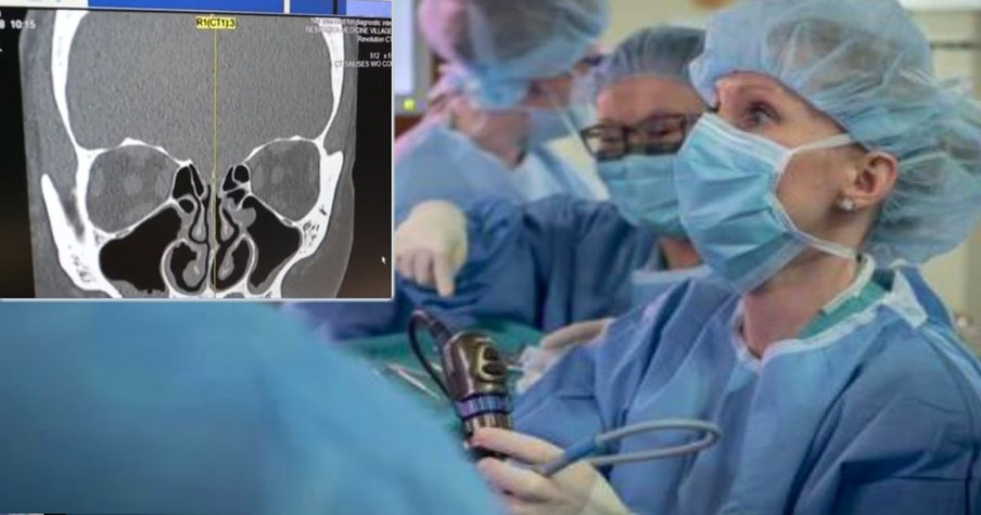 Doctor Makes Bizarre Discovery After Woman's Nose Runs Constantly For Years