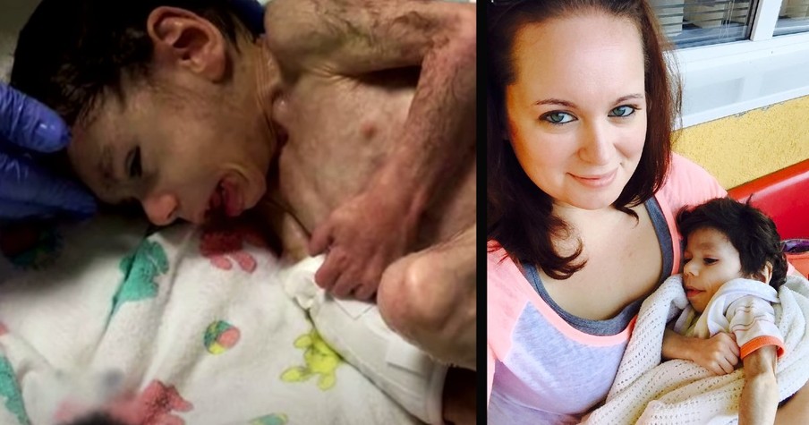 Stranger Steps in for 7-Year-Old Orphan Weighing Just 8-lbs and Her Love Is Saving Baby Ryan