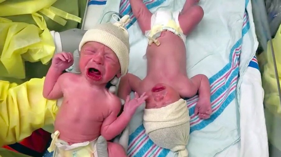 Newborn Twins Won't Stop Crying When They're Separated At Birth