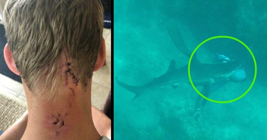 Man Thanks God For New Perspective On Life After Surviving Deadly Shark Attack