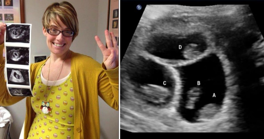 Doctors Urged Single Mom To Abort Her Quadruplets To Save Her Own Life